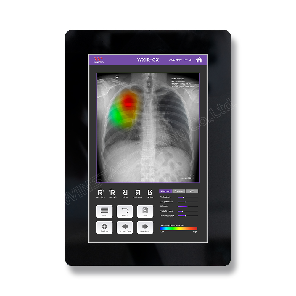 7 inch Vertical Touch Screen Display